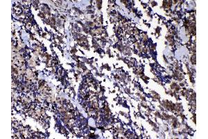 IHC analysis of Ran using anti-Ran antibody . (RAN antibody  (AA 2-216))