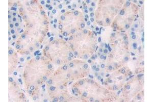DAB staining on IHC-P; Samples: Rat Kidney Tissue (FLT1 antibody  (AA 303-524))