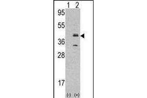 Western blot analysis of MVK (arrow) using rabbit polyclonal MVK Antibody (N-term) (ABIN392802 and ABIN2842240). (MVP antibody  (N-Term))