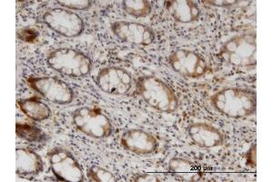 Immunoperoxidase of monoclonal antibody to ZNRF1 on formalin-fixed paraffin-embedded human colon. (ZNRF1 antibody  (AA 74-178))