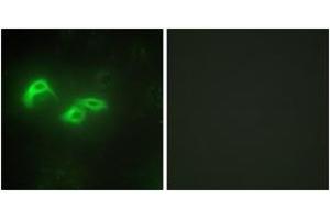 Immunofluorescence analysis of HepG2 cells, using TFAM Antibody. (TFAM antibody  (AA 131-180))