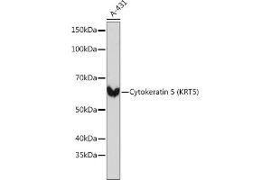 Western blot analysis of extracts of A-431 cells, using Cytokeratin 5 (KRT5) (KRT5) Rabbit mAb (ABIN7268103) at 1:1000 dilution. (Cytokeratin 5 antibody)