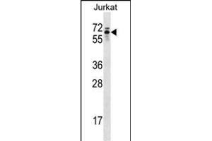 TROVE2 Antibody (C-term) (ABIN1537371 and ABIN2848873) western blot analysis in Jurkat cell line lysates (35 μg/lane). (TROVE2 antibody  (C-Term))