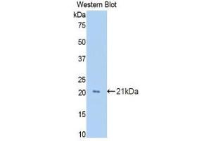 Western Blotting (WB) image for anti-Growth Arrest-Specific 6 (GAS6) (AA 356-511) antibody (ABIN1858964)