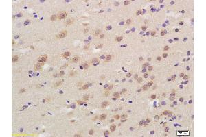 Immunohistochemistry (IHC) image for anti-Calcium Channel, Voltage-Dependent, L Type, alpha 1D Subunit (CACNA1D) (AA 1201-1300) antibody (ABIN751333)