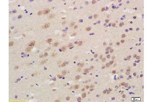 Formalin-fixed and paraffin embedded rat brain labeled with Anti-CACH3/CaV1. (CACNA1D antibody  (AA 1201-1300))