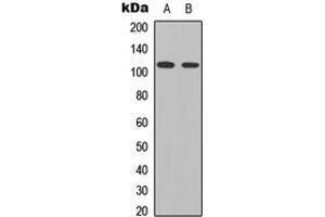 Western Blotting (WB) image for anti-Signal Transducer and Activator of Transcription 2, 113kDa (STAT2) (C-Term), (pTyr690) antibody (ABIN7301334)