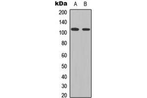 Western blot analysis of STAT2 (pY690) expression in HeLa (A), K562 (B) whole cell lysates.