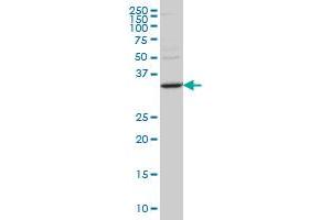 STAU2 monoclonal antibody (M10), clone 2C8 Western Blot analysis of STAU2 expression in SW-13 . (Double-stranded RNA-binding protein Staufen homolog 2 (STAU2) (AA 2-90) antibody)