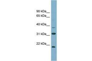 Image no. 1 for anti-N-6 Adenine-Specific DNA Methyltransferase 1 (Putative) (N6AMT1) (N-Term) antibody (ABIN6743395)