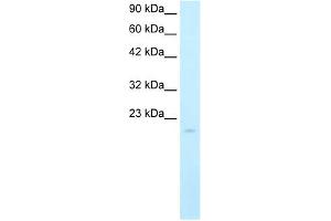 Western Blot showing SP140 antibody used at a concentration of 5.