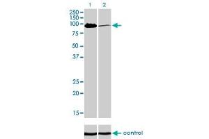 Western blot analysis of MCC over-expressed 293 cell line, cotransfected with MCC Validated Chimera RNAi (Lane 2) or non-transfected control (Lane 1).