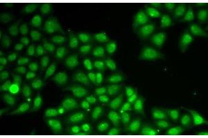 Immunofluorescence (IF) image for anti-Flap Structure-Specific Endonuclease 1 (FEN1) antibody (ABIN7255764)