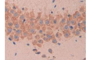 MUC1 antibody  (AA 410-525)
