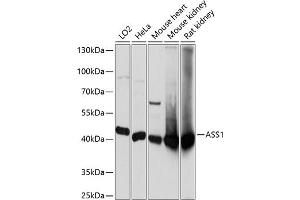 Western blot analysis of extracts of various cell lines, using  antibody  at 1:3000 dilution. (ASS1 antibody  (AA 1-412))
