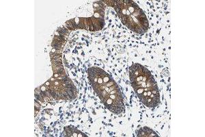 Immunohistochemical staining of human colon with TJP2 polyclonal antibody  shows moderate cytoplasmic and membranous positivity in glandular cells at 1:50-1:200 dilution. (TJP2 antibody)