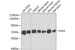 Western blot analysis of extracts of various cell lines using PCK2 Polyclonal Antibody at dilution of 1:1000. (PEPCK antibody)