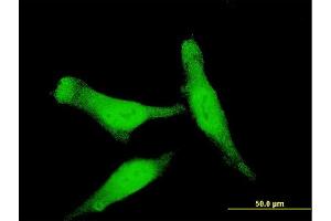 Immunofluorescence of monoclonal antibody to SMAD7 on HeLa cell. (SMAD7 antibody  (AA 160-260))