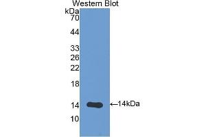 Western Blotting (WB) image for anti-V-Set Domain Containing T Cell Activation Inhibitor 1 (VTCN1) (AA 34-147) antibody (ABIN1176799) (VTCN1 antibody  (AA 34-147))
