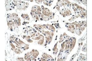 Immunohistochemistry (IHC) image for anti-Carbohydrate (Keratan Sulfate Gal-6) Sulfotransferase 1 (CHST1) (N-Term) antibody (ABIN2782241) (CHST1 antibody  (N-Term))
