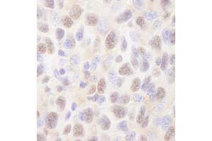 Immunohistochemistry (IHC) image for anti-Rad6 (N-Term) antibody (ABIN7448752) (Rad6 (N-Term) antibody)