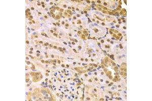 Immunohistochemistry (IHC) image for anti-Mitogen-Activated Protein Kinase Kinase 7 (MAP2K7) (AA 1-250) antibody (ABIN6219416) (MAP2K7 antibody  (AA 1-250))