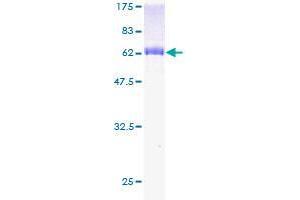 Image no. 1 for WD Repeat Domain 45 (WDR45) (AA 1-360) protein (GST tag) (ABIN1325233) (WDR45 Protein (AA 1-360) (GST tag))