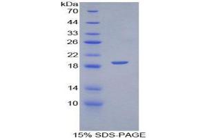 SDS-PAGE (SDS) image for Platelet/endothelial Cell Adhesion Molecule (PECAM1) (AA 78-214) protein (His tag) (ABIN1099389) (CD31 Protein (AA 78-214) (His tag))