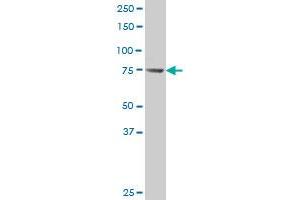 FARP2 polyclonal antibody (A01), Lot # 060124JC01 Western Blot analysis of FARP2 expression in SJCRH30 . (FARP2 antibody  (AA 360-448))