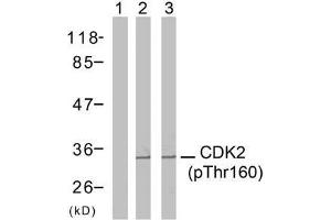 Western blot analysis of extracts from A2780 cells (Lane 1 and 2) and MDA-MB-435 cells (Lane 3), using CDK2 (phospho-Thr160) antibody (E011133).