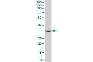 DECR1 antibody  (AA 236-335)