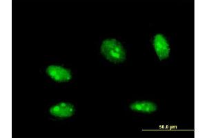 Immunofluorescence of monoclonal antibody to NANOG on HeLa cell. (Nanog antibody  (AA 98-195))