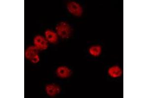 ABIN6275735 staining LOVO by IF/ICC. (Crossover junction endonuclease EME1 (EME1) (Internal Region) antibody)