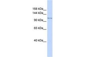 Image no. 1 for anti-Jumonji C Domain-Containing Histone Demethylase 1 Homolog D (JHDM1D) (AA 288-337) antibody (ABIN6744253) (JHDM1D antibody  (AA 288-337))