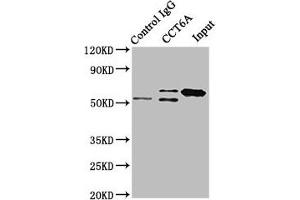 Immunoprecipitating CCT6A in Hela whole cell lysate Lane 1: Rabbit control IgG instead of ABIN7171432 in Hela whole cell lysate. (CCT6A antibody  (AA 80-250))