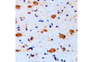 Immunohistochemical analysis of ARHGAP22 staining in human brain formalin fixed paraffin embedded tissue section. (ARHGAP22 antibody  (C-Term))