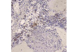 IHC analysis of DC-SIGN using anti-DC-SIGN antibody . (DC-SIGN/CD209 antibody)
