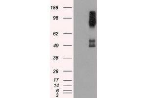Image no. 4 for anti-B-Raf proto-oncogene, serine/threonine kinase (BRAF) antibody (ABIN1496952) (BRAF antibody)