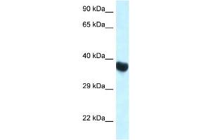 WB Suggested Anti-Hoxa10 Antibody Titration: 1.