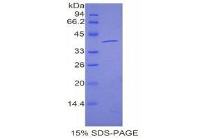 SDS-PAGE (SDS) image for Angiopoietin 4 (ANGPT4) (AA 32-144) protein (His tag,GST tag) (ABIN1878150)