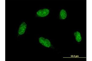 Immunofluorescence of monoclonal antibody to ATOH1 on HeLa cell. (ATOH1 antibody  (AA 266-354))