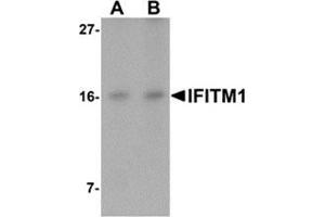 Western blot analysis of IFITM1 in Jurkat cell lysate with IFITM1 antibody at (A) 2. (IFITM1 antibody  (C-Term))