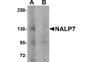 Western Blotting (WB) image for anti-NLR Family, Pyrin Domain Containing 7 (NLRP7) (N-Term) antibody (ABIN1031472)