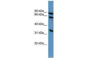 WB Suggested Anti-ELMO1 Antibody Titration: 0. (ELMO1 antibody  (C-Term))