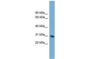 Image no. 1 for anti-Ficolin (Collagen/fibrinogen Domain Containing) 1 (FCN1) (AA 215-264) antibody (ABIN6745636) (FCN1 antibody  (AA 215-264))