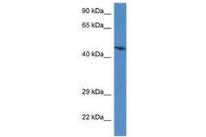 Image no. 1 for anti-Actin-Binding rho Activating Protein (ABRA) (AA 284-333) antibody (ABIN6747384) (ABRA antibody  (AA 284-333))