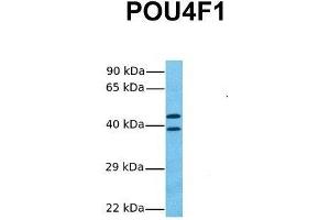 Host:  Rabbit  Target Name:  POU4F1  Sample Tissue:  Human Fetal Lung  Antibody Dilution:  1. (POU4F1 antibody  (C-Term))