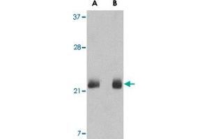 Western blot analysis of FGF4 in NIH NIH/3T3 cell lysate with FGF4 polyclonal antibody  at (A) 0.