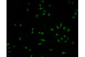 Immunofluorescence staining of SH-SY5Y cells with ABIN7152433 at 1:100, counter-stained with DAPI. (FBXO36 antibody  (AA 1-188))