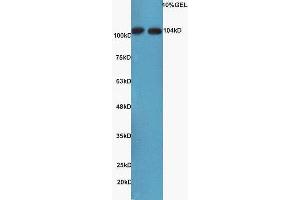 MAP3K14 antibody  (AA 901-947)